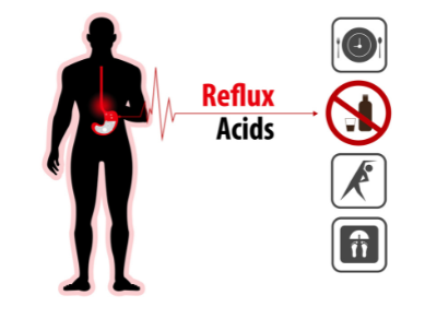 recover from acid reflux surgery