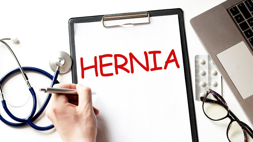 What Type of Doctor Treats Hernias