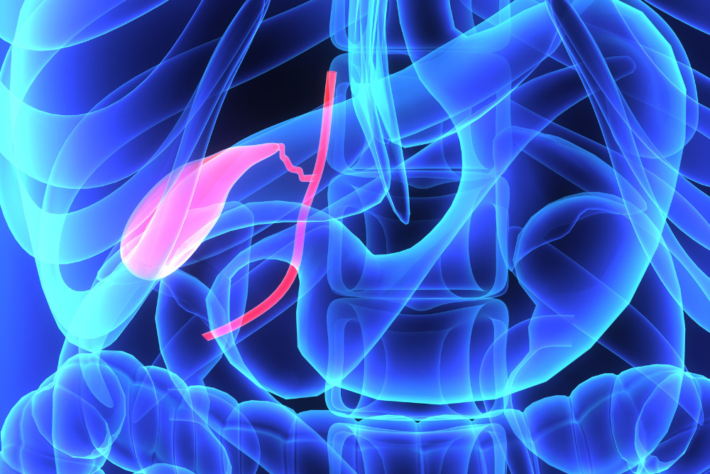 gallbladder surgery in Orange County, CA