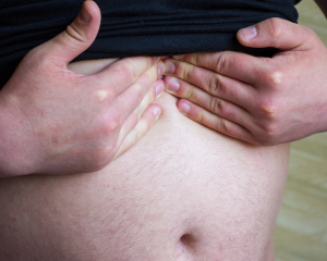 hernia
